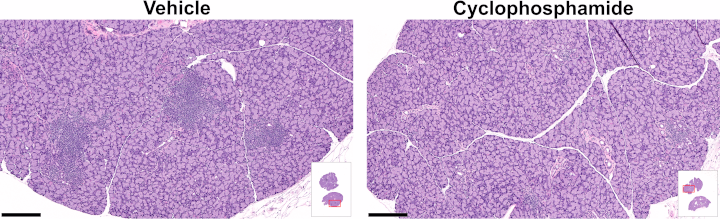 Lacrimal gland hematoxylin and eosin staining illustrative images